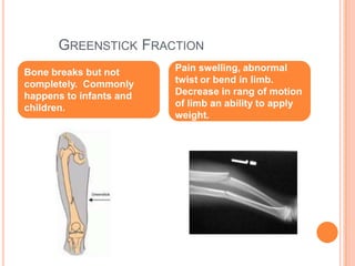          Greenstick FractionBone breaks but not completely.  Commonly happens to infants and children. Pain swelling, abnormal twist or bend in limb. Decrease in rang of motion of limb an ability to apply weight.