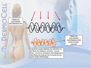 FIBRA DE
  COLÁGENO
RECIBIENDO RF




                                                                 FIBRA DE
                                                                COLÁGENO
                                                              CONTRAÍDA POR
                                                               EFECTO DEL
                                                                  CALOR

                Cuando el cuerpo detecta una variación en
                las fibras de colágeno, produce nuevas
                fibras y envía su remplazo (neocolagenosis)
                este efecto se produce con la ayuda de las
                HEAT SHOT PROTEINS
 