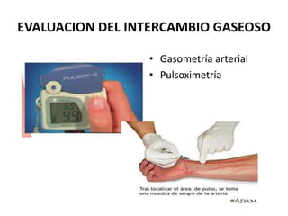 EVALUACION DEL INTERCAMBIO GASEOSO

                 • Gasometría arterial
                 • Pulsoximetría
 