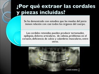 ¿Por qué extraer las cordales y piezas incluidas?  