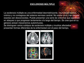 ESCLEROSIS MÚLTIPLE La esclerosis múltiple es una enfermedad desmielinizante, neurodegenerativa, crónica y no contagiosa del sistema nervioso central. No existe cura y las causas exactas son desconocidas. Puede presentar una serie de síntomas que aparecen en ataques o que progresan lentamente a lo largo del tiempo. Se cree que en su génesis actúan mecanismos autoinmunes. Se distinguen varios subtipos de esclerosis múltiple y muchos afectados presentan formas diferentes de la enfermedad con el paso del tiempo. 