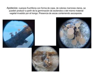 Apotecios:  cuerpos fructíferos con forma de copa, de colores marrones claros, se pueden producir a partir de la germinación de esclerotos o del mismo material vegetal invadido por el hongo. Presencia de ascas conteniendo ascosporas.                                                                                                        