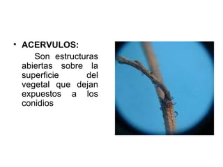 ACERVULOS: Son estructuras abiertas sobre la superficie del vegetal que dejan expuestos a los conidios  