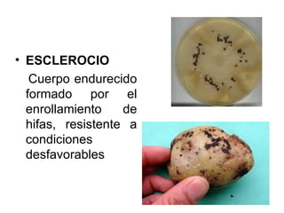 ESCLEROCIO Cuerpo endurecido formado por el enrollamiento de hifas, resistente a condiciones desfavorables 