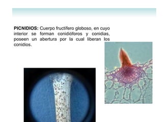 PICNIDIOS:  Cuerpo fructífero globoso, en cuyo interior se forman conidióforos y conidias, poseen un abertura por la cual liberan los conidios. 