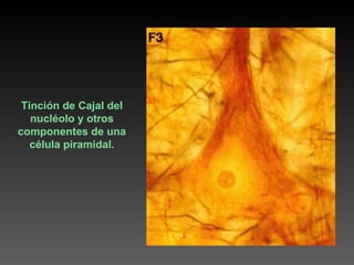 Tinción de Cajal del nucléolo y otros componentes de una célula piramidal. 
