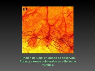 Tinción de Cajal en donde se observan fibras y axones colaterales en células de Purkinje. 
