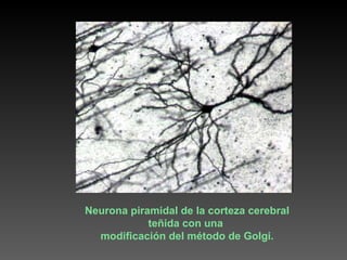 Neurona piramidal de la corteza cerebral teñida con una  modificación del método de Golgi. 