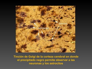 Tinción de Golgi de la corteza cerebral en donde el precipitado negro permite observar a las neuronas y los astrocitos 