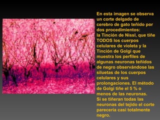 En esta imagen se observa un corte delgado de cerebro de gato teñido por dos procedimientos: la Tinción de Nissl, que tiñe TODOS los cuerpos celulares de violeta y la Tinción de Golgi que muestra los perfiles de algunas neuronas teñidos de negro observándose las siluetas de los cuerpos celulares y sus prolongaciones. El método de Golgi tiñe el 5 % o menos de las neuronas. Si se tiñeran todas las neuronas del tejido el corte parecería casi totalmente negro. 