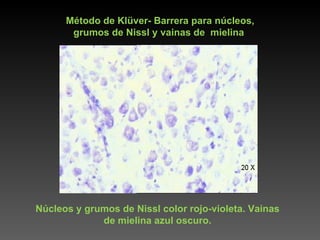 Núcleos y grumos de Nissl color rojo-violeta. Vainas de mielina azul oscuro. Método de Klüver- Barrera para núcleos, grumos de Nissl y vainas de  mielina 