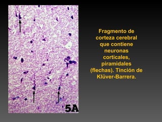 Fragmento de corteza cerebral que contiene neuronas corticales, piramidales (flechas). Tinción de Klüver-Barrera. 