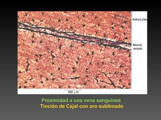 Proximidad a una vena sanguínea  Tinción de Cajal con oro sublimado 