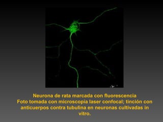 Neurona de rata marcada con fluorescencia Foto tomada con microscopía laser confocal; tinción con anticuerpos contra tubulina en neuronas cultivadas in vitro. 