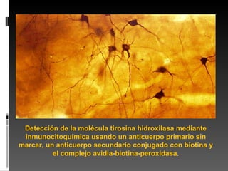 Detección de la molécula tirosina hidroxilasa mediante inmunocitoquímica usando un anticuerpo primario sin marcar, un anticuerpo secundario conjugado con biotina y el complejo avidia-biotina-peroxidasa. 