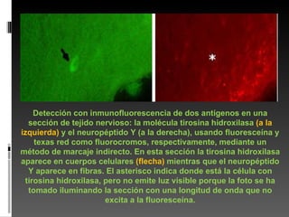 Detección con inmunofluorescencia de dos antígenos en una sección de tejido nervioso: la molécula tirosina hidroxilasa  (a la izquierda)  y el neuropéptido Y (a la derecha), usando fluoresceína y texas red como fluorocromos, respectivamente, mediante un método de marcaje indirecto. En esta sección la tirosina hidroxilasa aparece en cuerpos celulares  (flecha)  mientras que el neuropéptido Y aparece en fibras. El asterisco indica donde está la célula con tirosina hidroxilasa, pero no emite luz visible porque la foto se ha tomado iluminando la sección con una longitud de onda que no excita a la fluoresceína. 