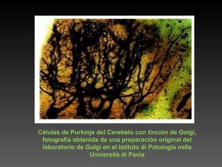 Células de Purkinje del Cerebelo con tinción de Golgi, fotografía obtenida de una preparación original del laboratorio de Golgi en el Istituto di Patologia nella Università di Pavia 