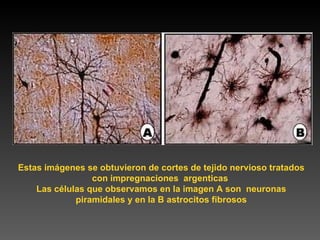 Estas imágenes se obtuvieron de cortes de tejido nervioso tratados con impregnaciones  argenticas  Las células que observamos en la   imagen A son  neuronas piramidales y en la B astrocitos fibrosos 