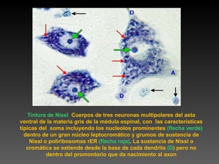 Tintura de Nissl   Cuerpos de tres neuronas multipolares del asta ventral de la materia gris de la médula espinal, con  las características típicas del  soma incluyendo los nucleolos prominentes  (flecha verde)   dentro de un gran núcleo leptocromático y grumos de sustancia de Nissl o poliribosomas rER  (flecha roja) .  La sustancia de Nissl o cromática se extiende desde la base de cada dendrita  (D ) pero no dentro del promontorio que da nacimiento al axon 
