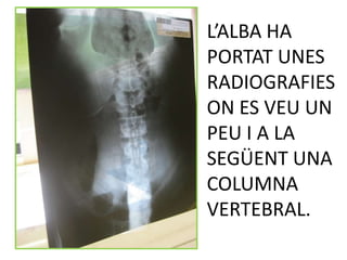 L’ALBA HA
PORTAT UNES
RADIOGRAFIES
ON ES VEU UN
PEU I A LA
SEGÜENT UNA
COLUMNA
VERTEBRAL.
 