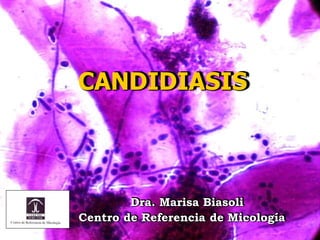 Dra. Marisa Biasoli
Centro de Referencia de Micología
CANDIDIASIS
 