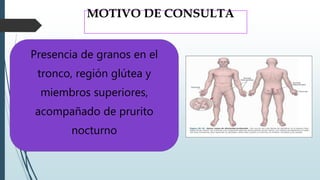 MOTIVO DE CONSULTA
Presencia de granos en el
tronco, región glútea y
miembros superiores,
acompañado de prurito
nocturno
 