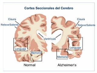 Cortes Seccionales del Cerebro


      Cisura                                                 Cisura

Relieve/Saliente    ...