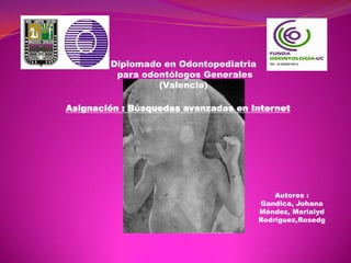 Diplomado en Odontopediatria
         para odontólogos Generales
                 (Valencia)

Asignación : Búsquedas avanzadas en Internet




                                           Autores :
                                       Gandica, Johana
                                       Méndez, Marialyd
                                       Rodriguez,Rosedg
 