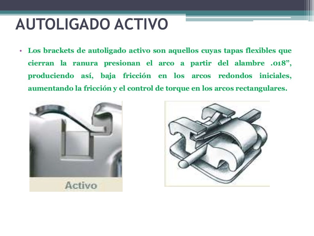 Autoligado activo vs pasivo torque slot anclaje