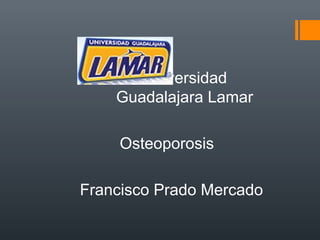 Universidad
Guadalajara Lamar
Osteoporosis
Francisco Prado Mercado
 