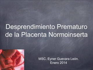 Desprendimiento Prematuro
de la Placenta Normoinserta

MSC. Eyner Guevara León.
Enero 2014

 