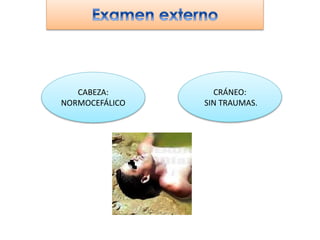 CABEZA:
NORMOCEFÁLICO
CRÁNEO:
SIN TRAUMAS.
 