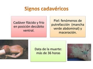 Cadáver flácido y frío
en posición decúbito
ventral.
Piel: fenómenos de
putrefacción (mancha
verde abdominal) y
maceración.
Data de la muerte:
más de 36 horas
 
