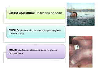 CUERO CABELLUDO: Evidencias de barro.
CUELLO: Normal sin presencia de patologías o
traumatismos.
TÓRAX: Livideces esternales, zona negruzca
para-esternal.
 