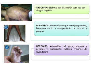 ABDOMEN: Globoso por distención causada por
el agua ingerida.
MIEMBROS: Maceraciones que semejan guantes,
blanqueamiento y arrugamiento de palmas y
plantas.
GENITALES: retracción del pene, escroto y
pezones y maceración cutánea ("manos de
lavandera")
 