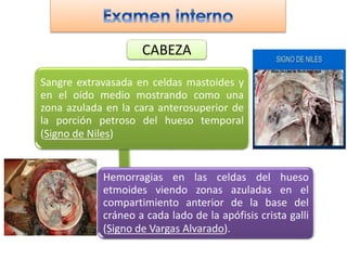 CABEZA
Sangre extravasada en celdas mastoides y
en el oído medio mostrando como una
zona azulada en la cara anterosuperior de
la porción petroso del hueso temporal
(Signo de Niles)
Hemorragias en las celdas del hueso
etmoides viendo zonas azuladas en el
compartimiento anterior de la base del
cráneo a cada lado de la apófisis crista galli
(Signo de Vargas Alvarado).
 