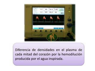 Diferencia de densidades en el plasma de
cada mitad del corazón por la hemodilución
producida por el agua inspirada.
 