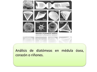 Análisis de diatómeas en médula ósea,
corazón o riñones.
 