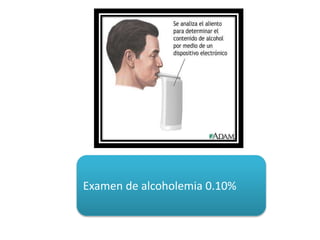 Examen de alcoholemia 0.10%
 