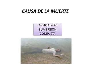 CAUSA DE LA MUERTE
ASFIXIA POR
SUMERSIÓN
COMPLETA
 