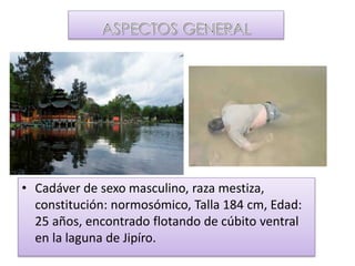 • Cadáver de sexo masculino, raza mestiza,
constitución: normosómico, Talla 184 cm, Edad:
25 años, encontrado flotando de cúbito ventral
en la laguna de Jipíro.
 