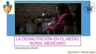 LA DESNUTRICIÓN EN EL MEDIO
RURAL MEXICANO
Desnutrición infantil.
Shunashi J. Palma López.
 