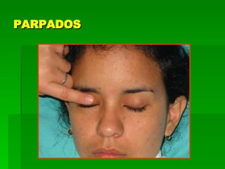 PARPADOS 