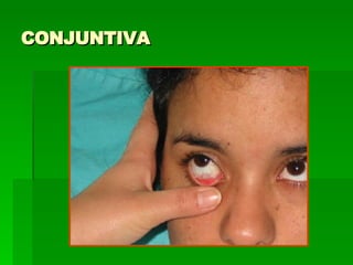 CONJUNTIVA 