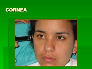 CORNEA 