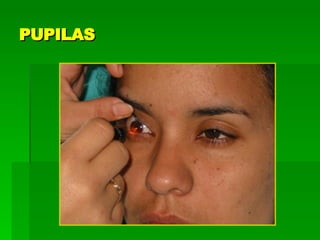 PUPILAS 