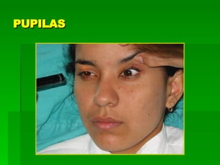 PUPILAS 