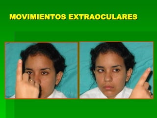 MOVIMIENTOS EXTRAOCULARES 