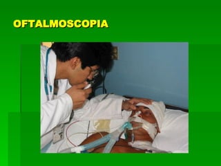 OFTALMOSCOPIA 