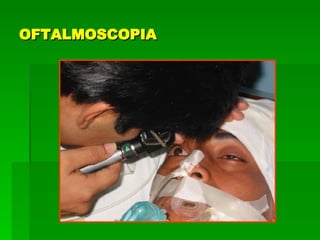 OFTALMOSCOPIA 